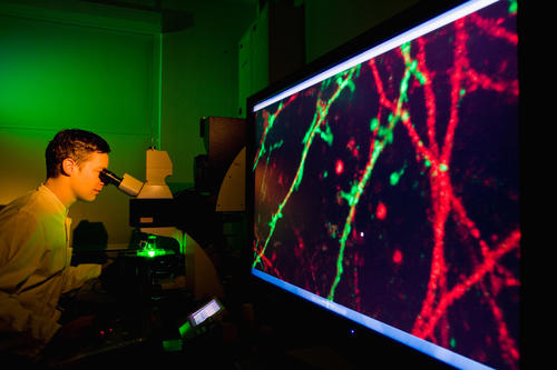 Blick ins Fluorenszenzmikroskop: Im Exzellenzcluster NeuroCure gehen Wissenschaftlerinnen und Wissenschaftler Mechanismen neurologischer Erkrankungen auf den Grund.