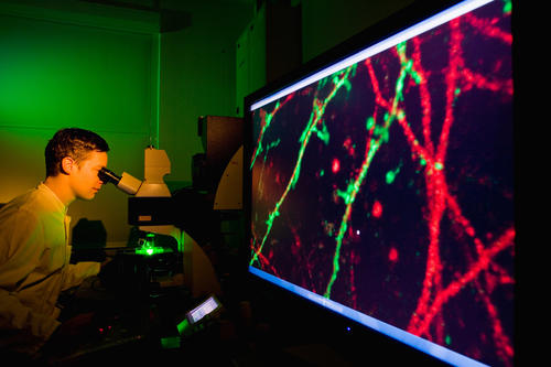 A look into the fluorescent microscope: In the NeuroCure Excellence Cluster, scientists investigate the mechanisms of neurological illnesses.