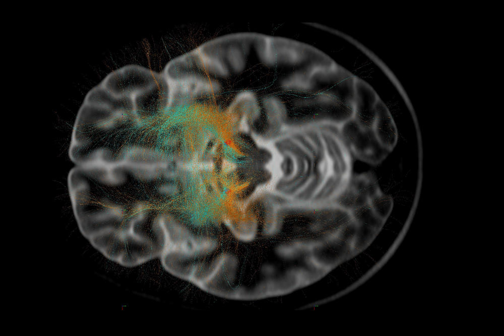 NeuroCure aims to find new perspectives in the treatment of neurological diseases.