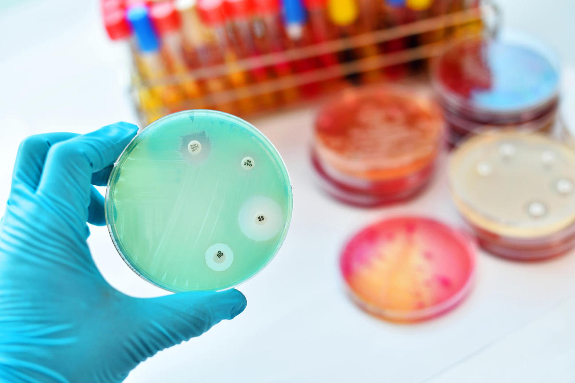 Four drops of different antibiotics were applied to a bacterial lawn dyed green. The white ring around each one varies in thickness, showing how effective the antibiotic is. The white spots are where the bacteria have been killed.