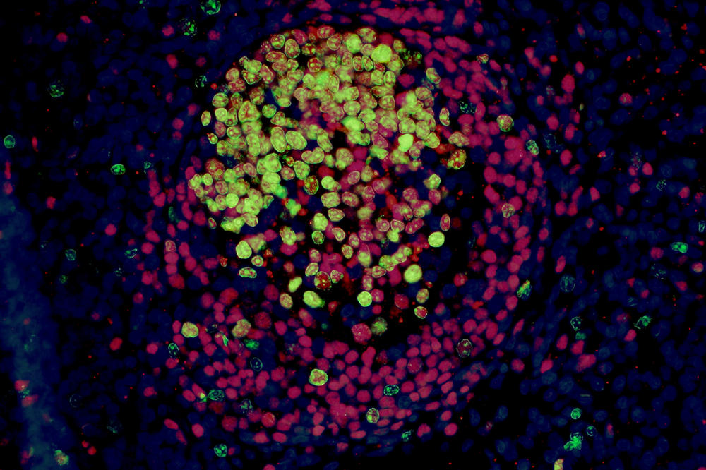 Das Bild zeigt eine Immunfluoreszenz eines Lymphfollikels mit aktivem Keimzentrum nach erfolgreicher Impfung mit Lebendimpfstoff.